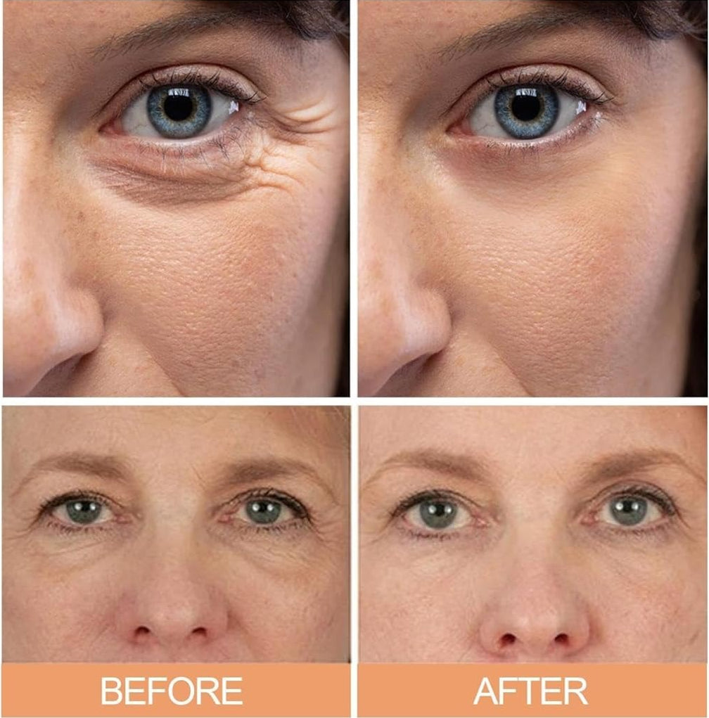 Before and after comparison of an anti-wrinkle moisturizing stick on a person's face.